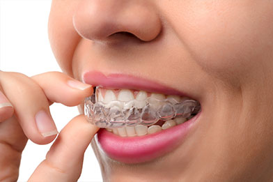 Invisalign Dentist Fairway KS